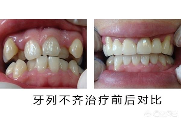 玉环最新24小时牙医在线咨询方法分析(最方便真实的玉环有没有24小时牙医方法)